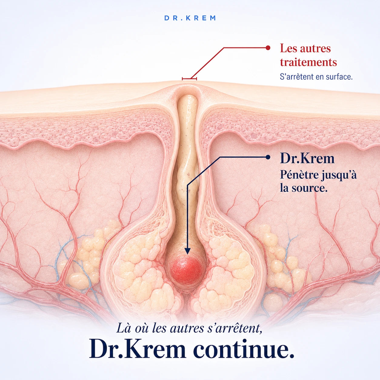 DR.KREM — Solution Acné Ciblée
